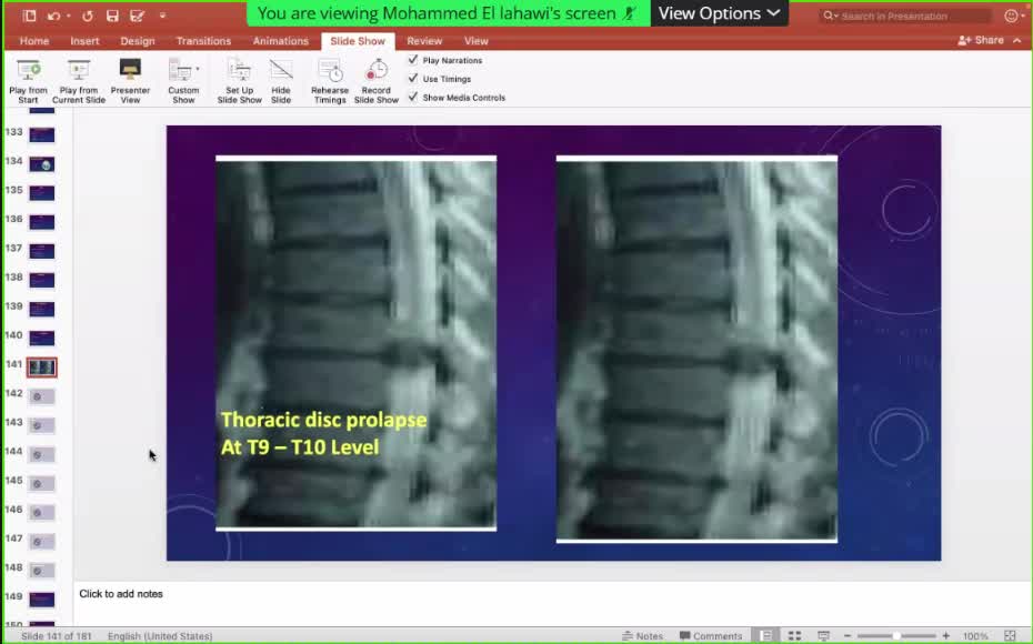 ST5.62 year old man with LL weakness for few days