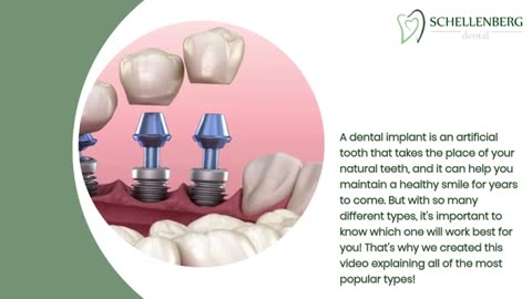 Discover the Best Dental Implants for YOU: Exploring Different Types & Materials