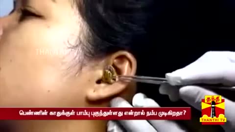 Snake Enters Woman's Ear