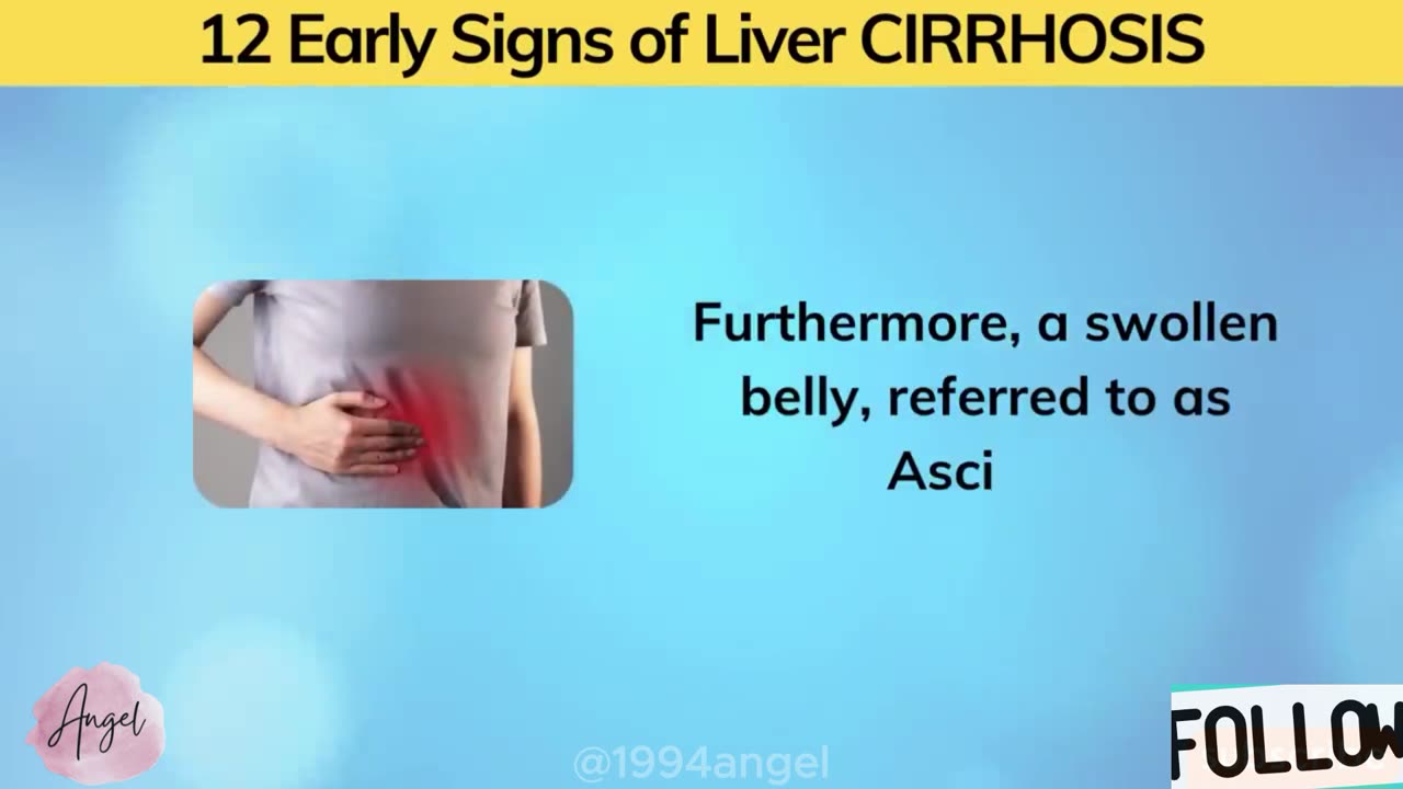 DON'T IGNORE! 12 Early Signs of Liver CIRRHOSIS