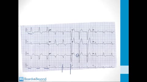 Cardiology - 3. EKGs - 2.High Yield EKGs