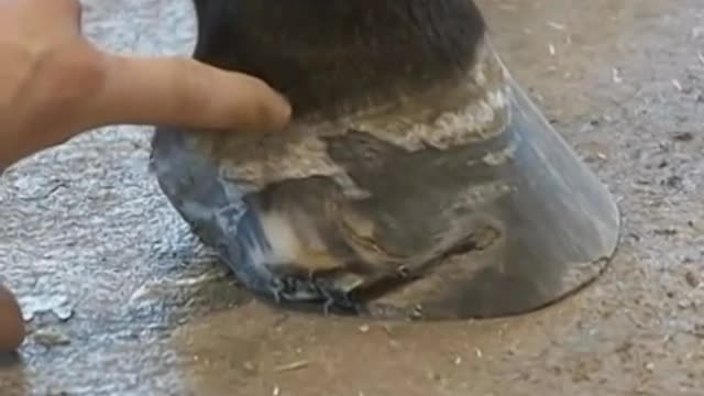 Rood & Riddle Podiatry Treating a Quarter Crack