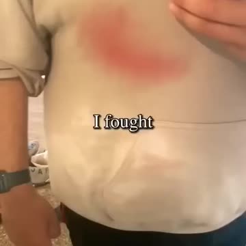 heaviest weight loss transformation ever #glowup #weightloss #weightlosschallenge