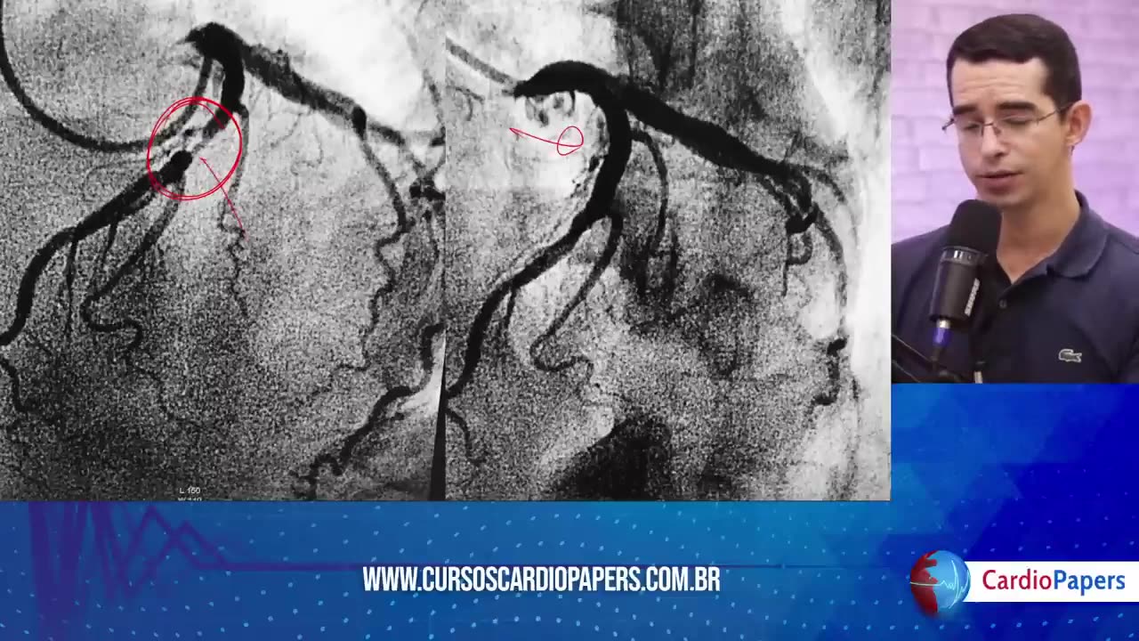 Aula 1 - Dominando os 10 padrões de ECG que matam