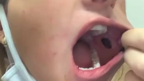 Side Effects After Taking The V@x 😔
