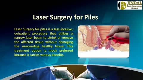 Advantages & Disadvantages of Laser Piles surgery – Dr Jindal