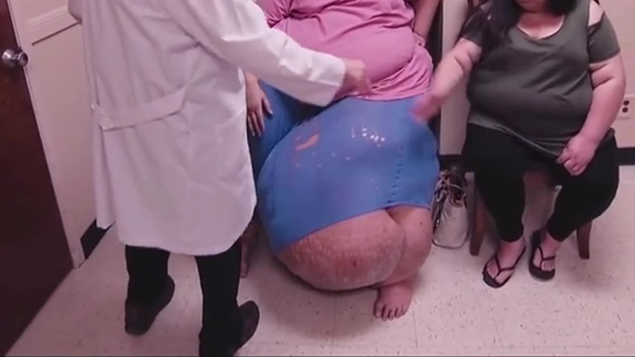 Patient loss 600 Ibs