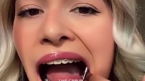 trap