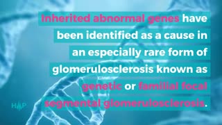 What Causes Focal Segmental Glomerulosclerosis?