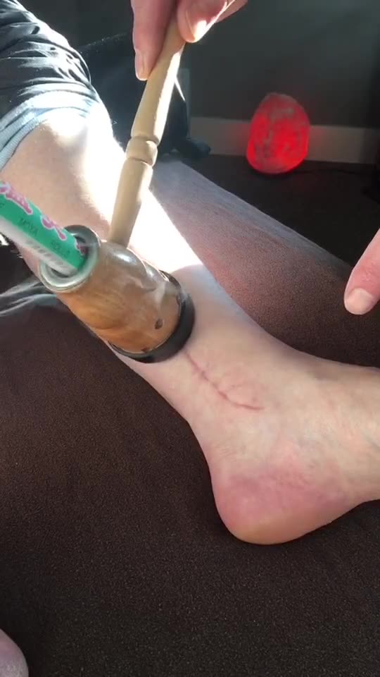 keep calm and moxa on