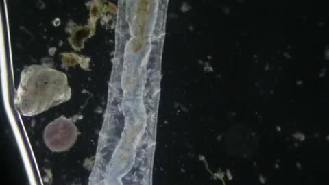 Earthworm Under Microscope_Cut