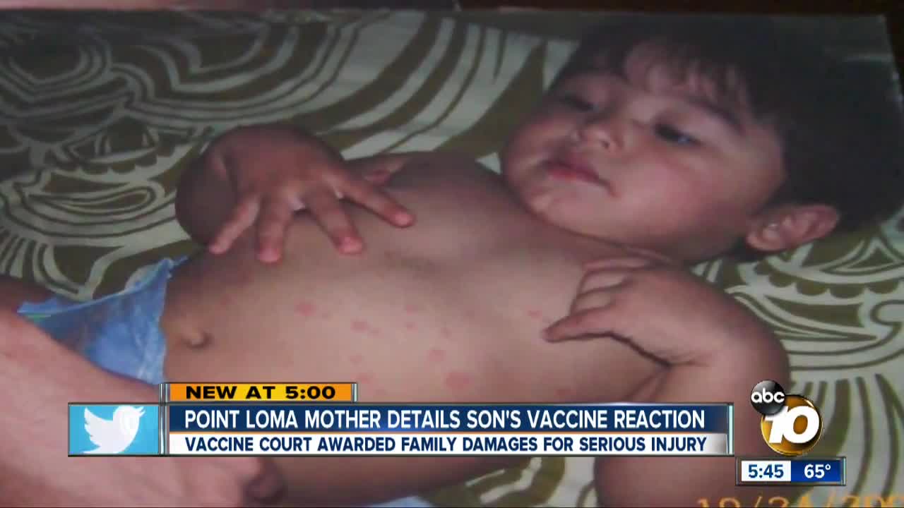 Leyo Smith's Vaccine Reaction: Rash, Tics Seizures and Autism