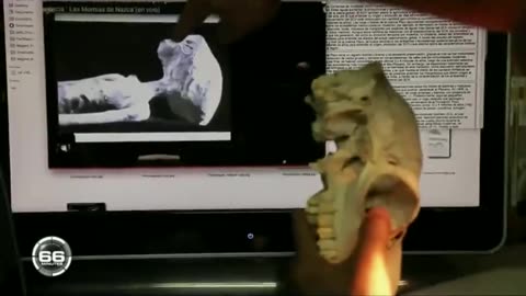 NASCA ALIENS IN MEXICO THEIR ANATOMY DISCOVERED AND SHOWN TO THE WORLD