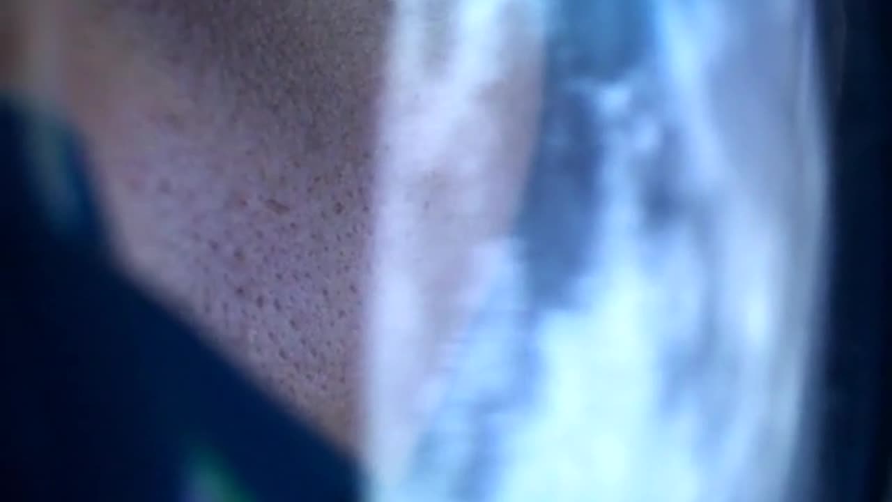 Random video