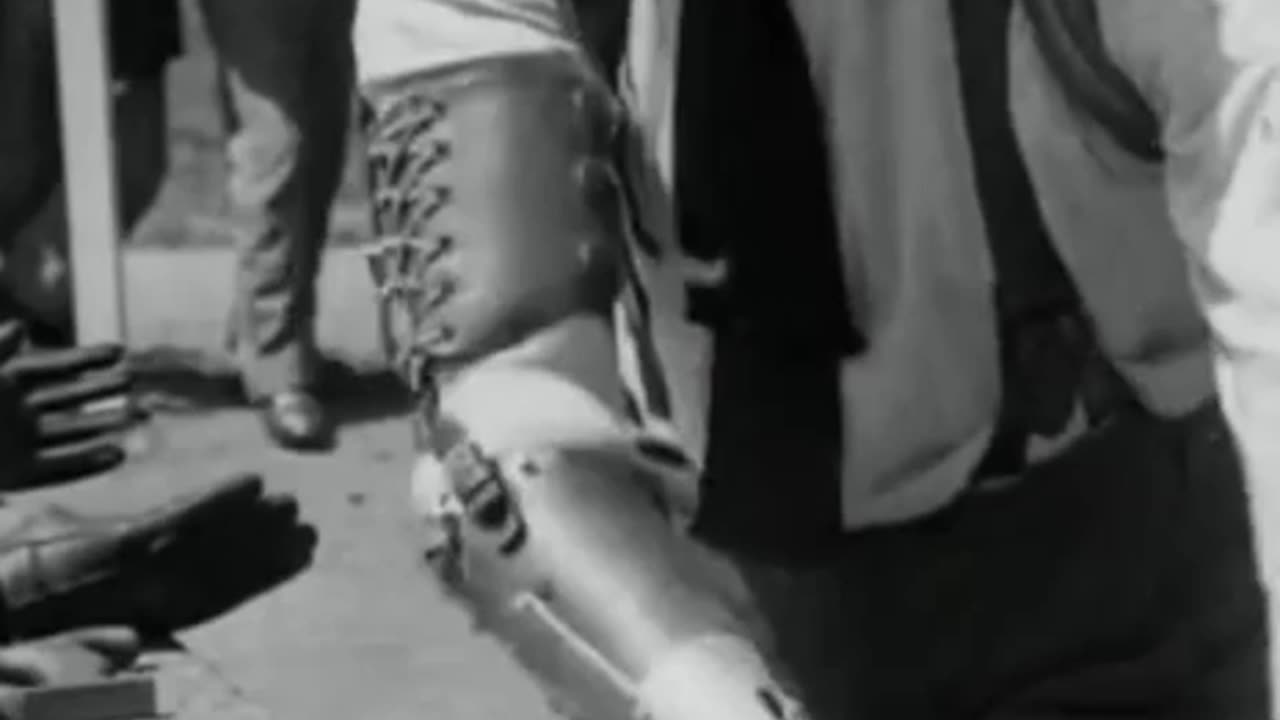 PROSTHESIS IN 1921 ARTICULATED USEABLE AND MANEUVERABLE
