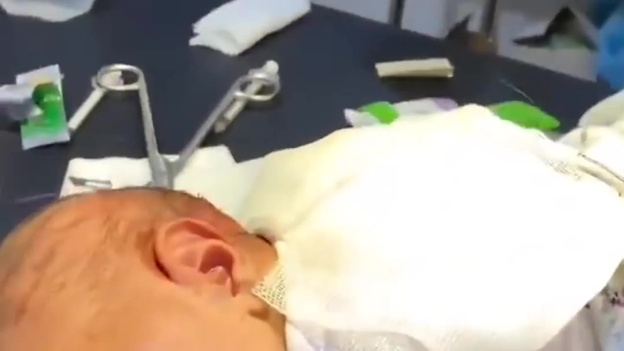 Just born to be injured by Israeli airstrike