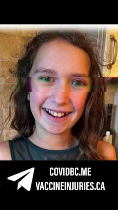 תופעת לוואי מוות בתו בת ה-10 של עובד גונסון וגונסון (יצרנית חיסון קורנה) מתה בפתאומיות מזק מוחי שנגרם מפרכוס 2023