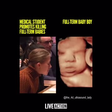 Medical Student Promotes Abortions For Full-Term Babies