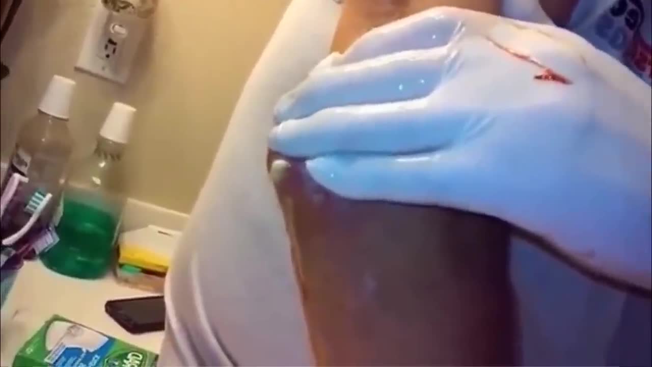 TOP 50 VIDEO 😱 Disturbing Pimple Popping 2022😱
