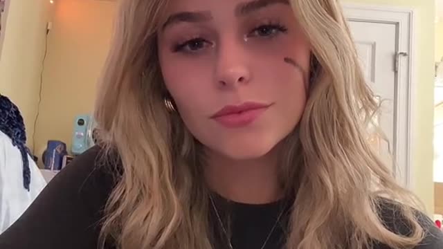 "I don't even notice the scar when I'm talking to you”