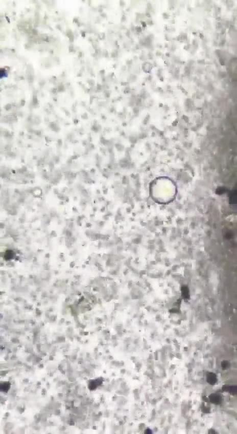 Ownwed by the Elites?Tap water is the most underrated cause of disease