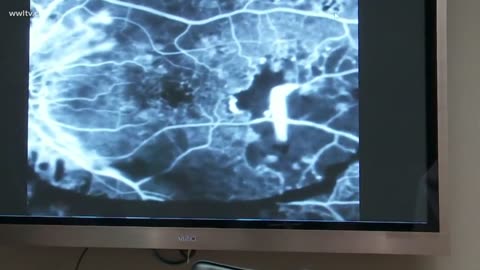 Hugo Talks - Blue Light, Mind Control, CRT TV's, The Amish & Optogenetics