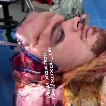 Takie rzeczy tylko u szczęściarzy