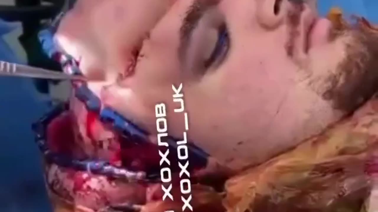 Takie rzeczy tylko u szczęściarzy