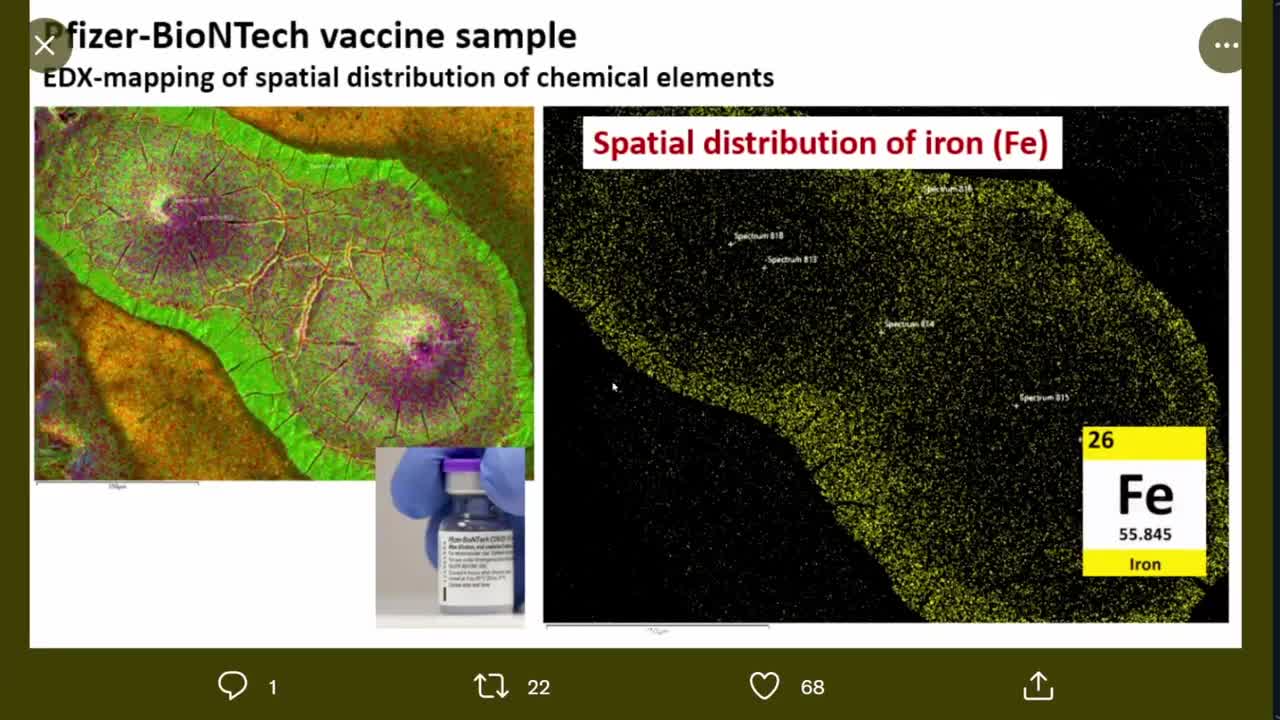 WHISTLEBLOWER: Doctor Shows Metal Particles Found In Jab By German University Analysis