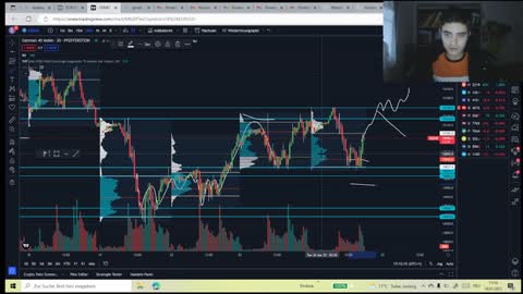 Refocus tells you how to trade 600dollars Profit