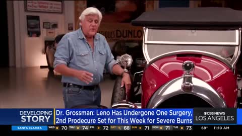 Jay Leno is expected to fully recover from burn injuries