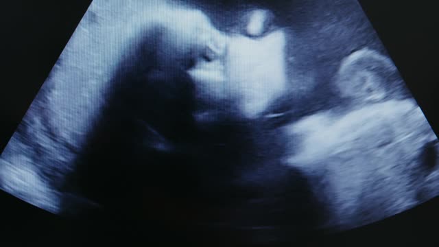 baby in the belly