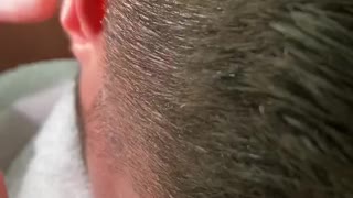 Massive Wad of Earwax