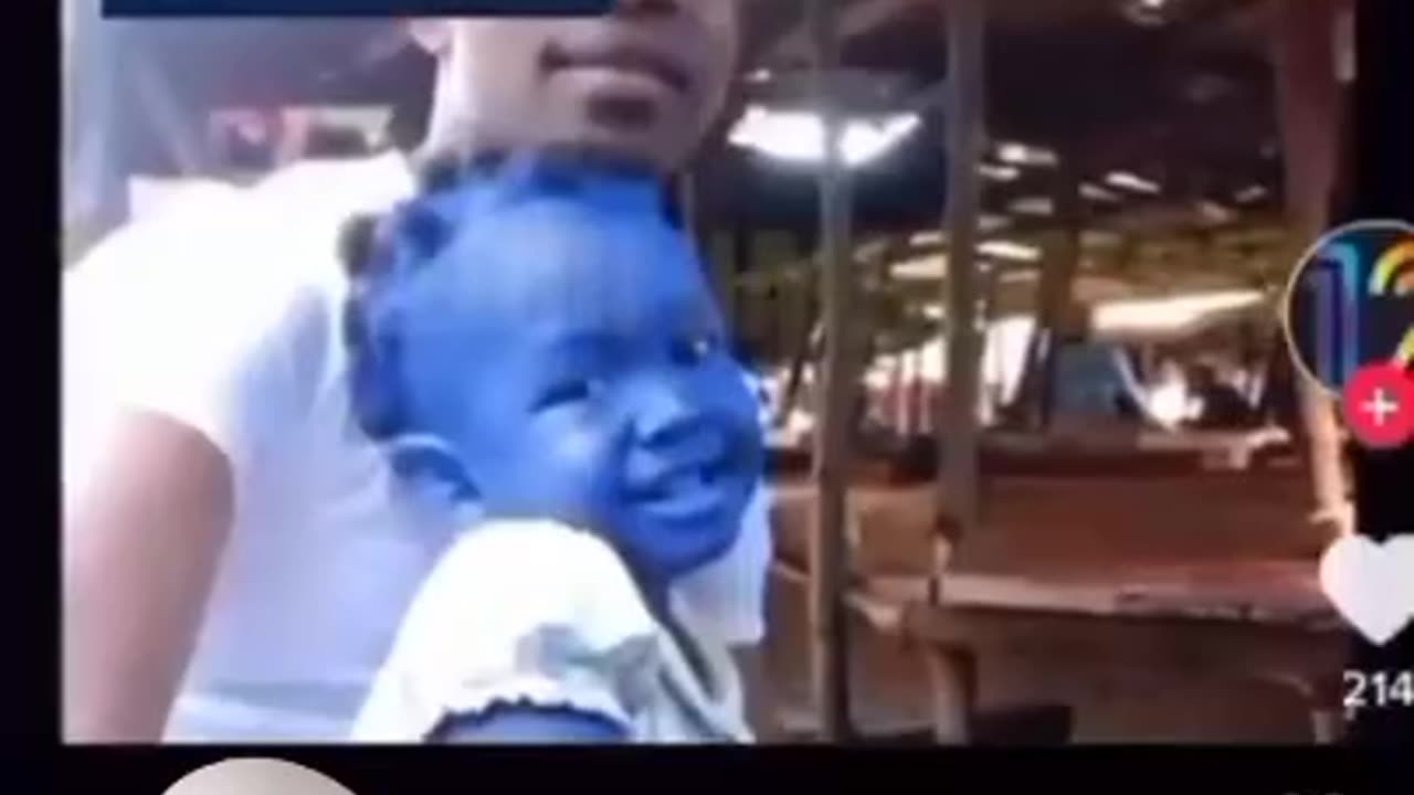 This Baby Has One Of Our True Cosmic Color Blue