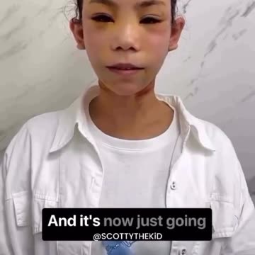 Face Implants | China, like Ukraine, are huge players when it comes to organ harvesting.