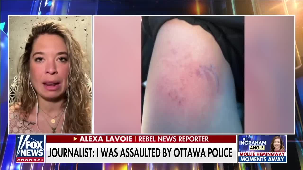 Why did Canadian police single out women and the elderly for attacks