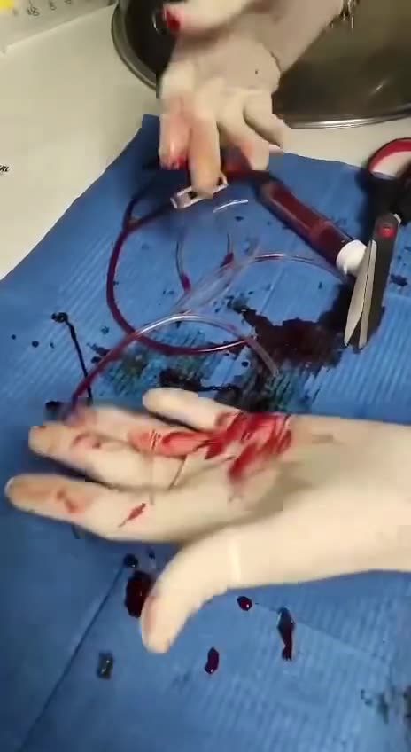 Oltás következménye (vérrög)