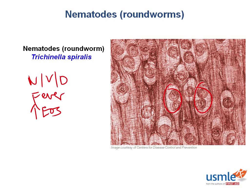 Nematodes (roundworms)