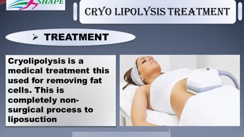 Cryo lipolysis Treatment in Preet Vihar, Delhi