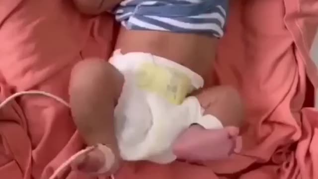🔥 📢ANGLIJA. MAMĄ PRIEŠ GIMDYMĄ SUVAKCINAVO REZULTATAS AIŠKUS 🔥 📢
