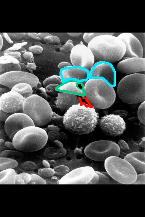 Up A's nose in Blood