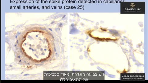 *יום הדיונים ה-4 להליך ה Grand Jury, משפט העם- פרופ'- ד"ר ארנה בוקהארט*