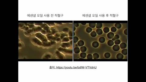코로나19 백신의 실체 2
