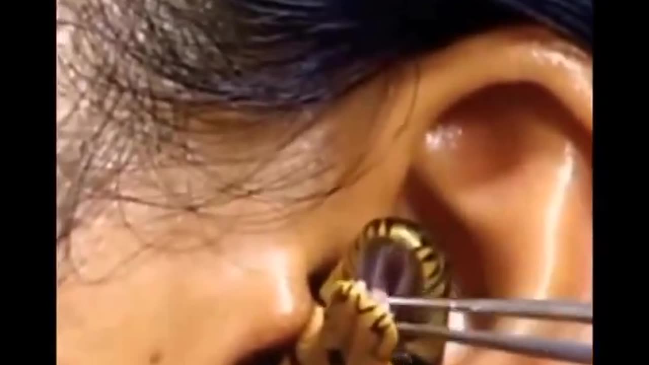 Snake In The Ear