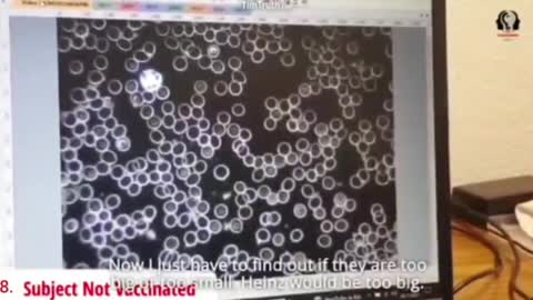 SANGUE DEI VACCINATI E NON VACCINATI A CONFRONTO (SECONDA PARTE)