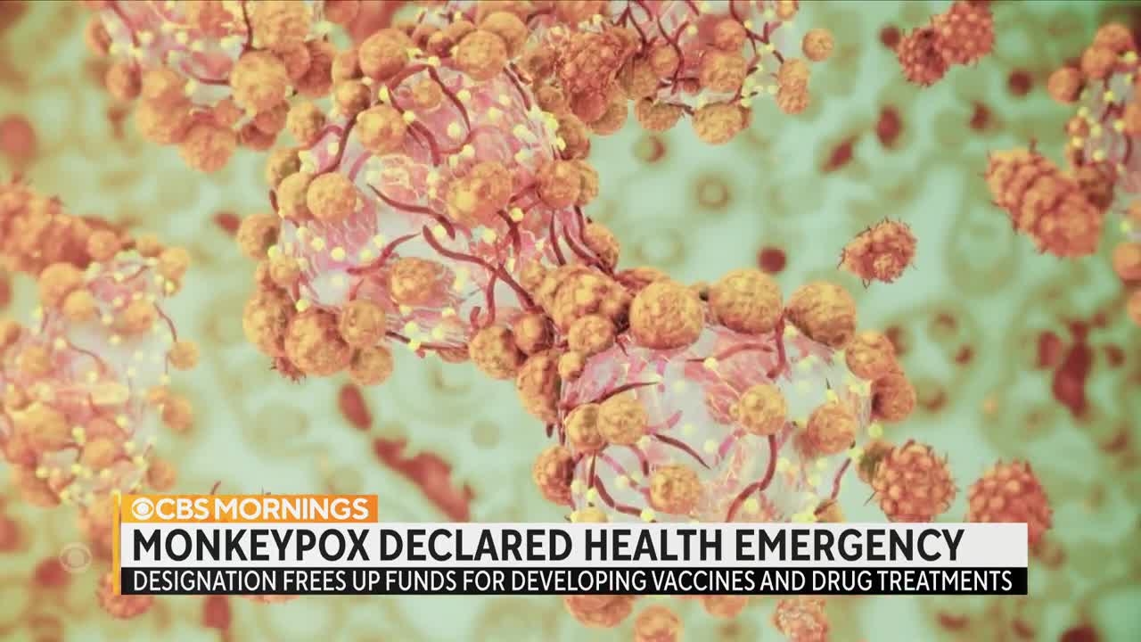 Monkeypox declared a public health emergency as virus spreads nationwide