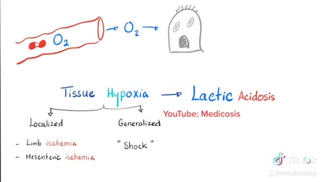 Lactic Acidosis and Tissue Ischemia