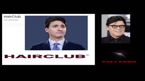WHAT IS UP WITH JUSTIN TRUDEAU'S HAIR ?