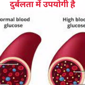 डायबिटीज कंट्रोल करने के लिए आज से ही शुरू करें