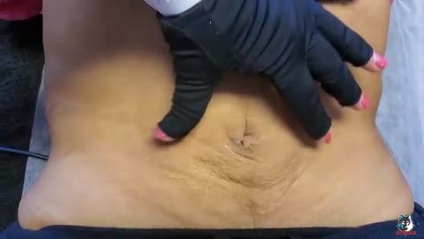 Belly Shaping - 01